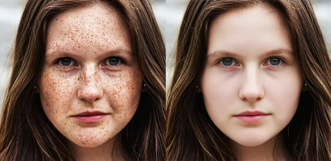 Remove Facial Blemishes Example - FlexClip